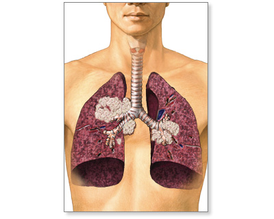 Health Topics Symptoms In-Depth Reports