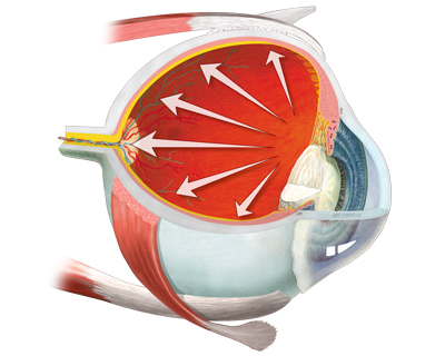 Diabetes Complications