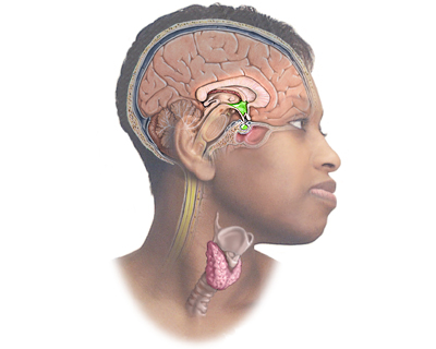 Symptoms