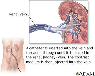 <p><strong>Renal veins</strong></p>