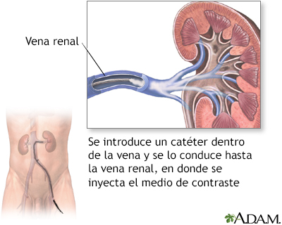<p><strong>Venas renales</strong></p>