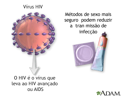 HIV
