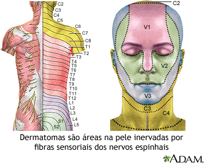 Dermatoma em adultos