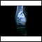 Sarcoma osteogênico - Raio x
