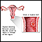 sangramento entre menstruações