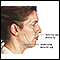 Facelift - série