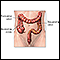 Intestino grosso