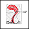 Câncer cervical
